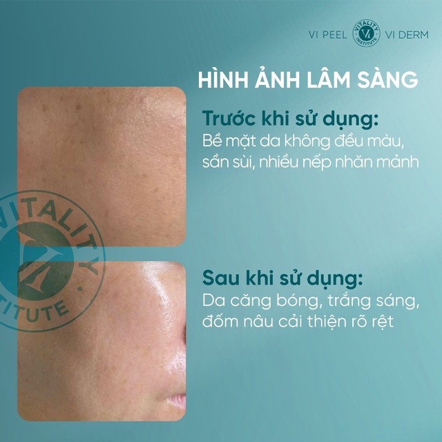 Tưởng filter, ai ngờ U40 trẻ như 20 nhờ 3 kem trắng da chống l&atilde;o h&oacute;a n&agrave;y!- Ảnh 3.