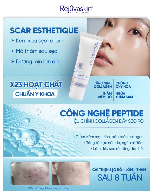 Review kem l&agrave;m mờ sẹo rỗ do mụn Scar Esthetique với lượt b&aacute;n top đầu tr&ecirc;n TikTok? - Ảnh 3.