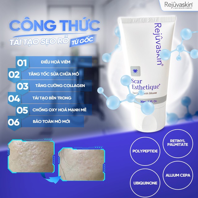 Review kem l&agrave;m mờ sẹo rỗ do mụn Scar Esthetique với lượt b&aacute;n top đầu tr&ecirc;n TikTok? - Ảnh 9.