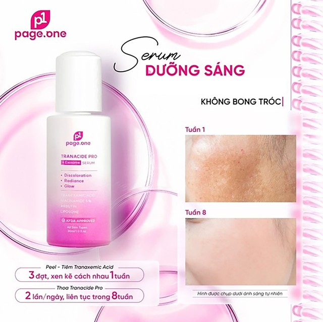 5 kem giúp mờ nám da trắng sáng sau khoảng 4 tuần, kể cả nám hỗn hợp - Ảnh 11.