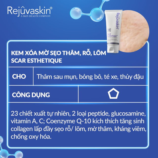 Vì sao nhiều người trị sẹo mãi không hiệu quả dù rất chăm skincare? - Ảnh 5.