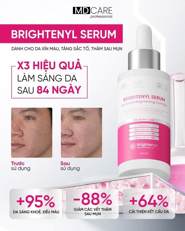 5 kem giúp mờ nám da trắng sáng sau khoảng 4 tuần, kể cả nám hỗn hợp - Ảnh 7.