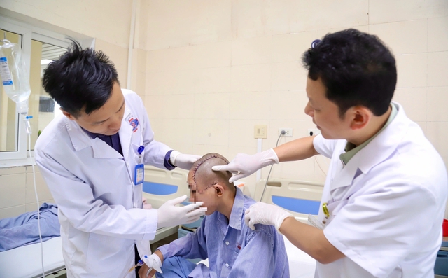 Điều trị khối u ác gây biến dạng vùng mặt cậu bé người Dao - Ảnh 1.