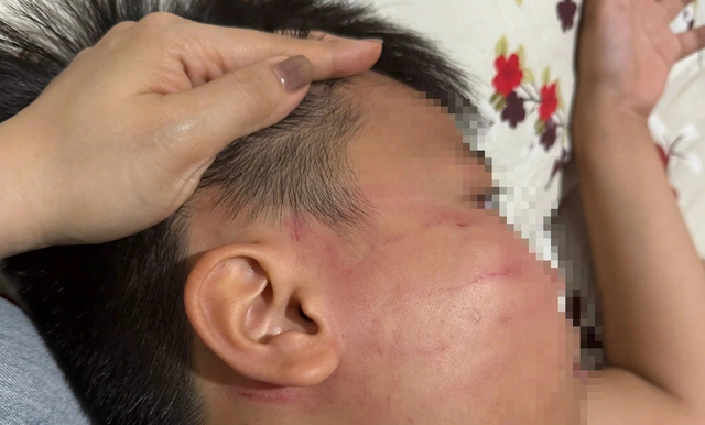 Thầy giáo người Ấn Độ bị tố tát học sinh lớp 4- Ảnh 1. Thầy giáo người Ấn Độ bị tố tát học sinh lớp 4- Ảnh 1.