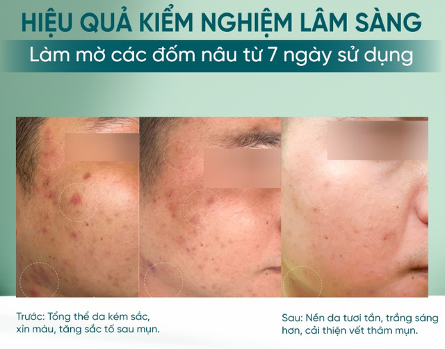 Top 5 serum cấp ẩm đang cháy hàng vì giúp da căng bóng như dùng filter - Ảnh 10.
