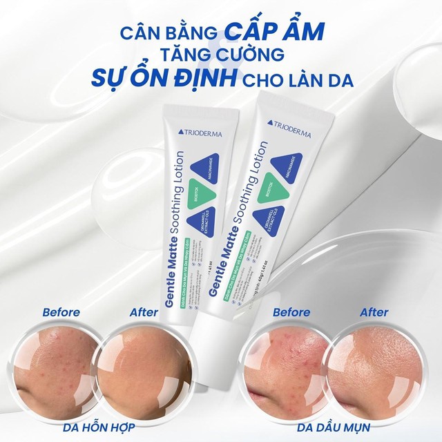 Top 5 serum cấp ẩm đang cháy hàng vì giúp da căng bóng như dùng filter - Ảnh 8.