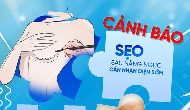 Phẫu thuật thẩm mỹ ngực: Đừng để h&agrave;nh tr&igrave;nh t&igrave;m lại tự tin &lsquo;đứt g&aacute;nh&rsquo; v&igrave; sẹo - Ảnh 1.
