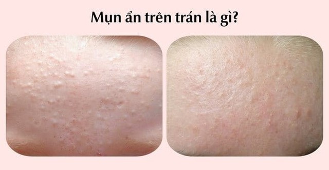 Kem chấm mụn tr&ecirc;n tr&aacute;n n&agrave;o c&oacute; lượt b&aacute;n top đầu TikTok hiện nay?- Ảnh 2.