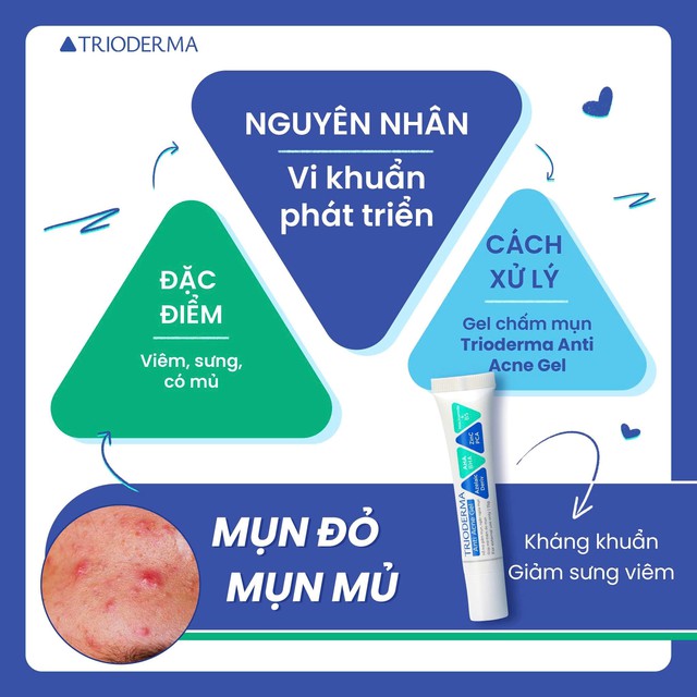 Kem chấm mụn tr&ecirc;n tr&aacute;n n&agrave;o c&oacute; lượt b&aacute;n top đầu TikTok hiện nay?- Ảnh 3.