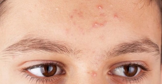 Kem chấm mụn tr&ecirc;n tr&aacute;n n&agrave;o c&oacute; lượt b&aacute;n top đầu TikTok hiện nay?- Ảnh 5.