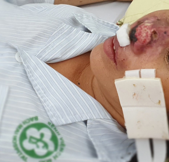 Bệnh 'sốt đất' dễ bị chẩn đo&aacute;n nhầm v&agrave; diễn biến nặng - Ảnh 1.