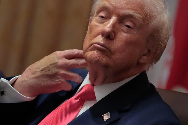 Bác sĩ của ông Trump nói gì sau đợt kiểm tra sức khỏe? - Ảnh 1.