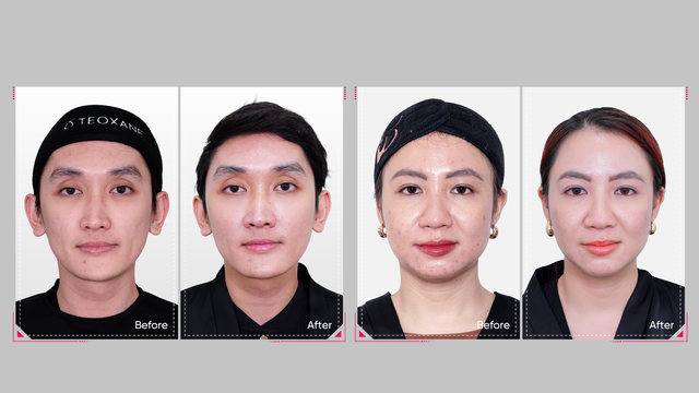BichNa Clinic ra mắt ph&aacute;c đồ mới trị sẹo, trẻ h&oacute;a to&agrave;n diện - Ảnh 2.