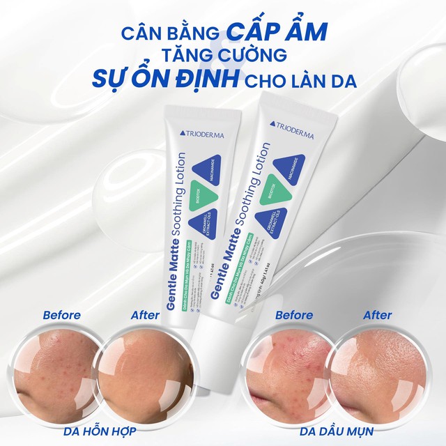 Hướng dẫn sử dụng lotion l&agrave;m khỏe da Trioderrma Gentle Matte Soothing Lotion chuẩn y khoa - Ảnh 5.