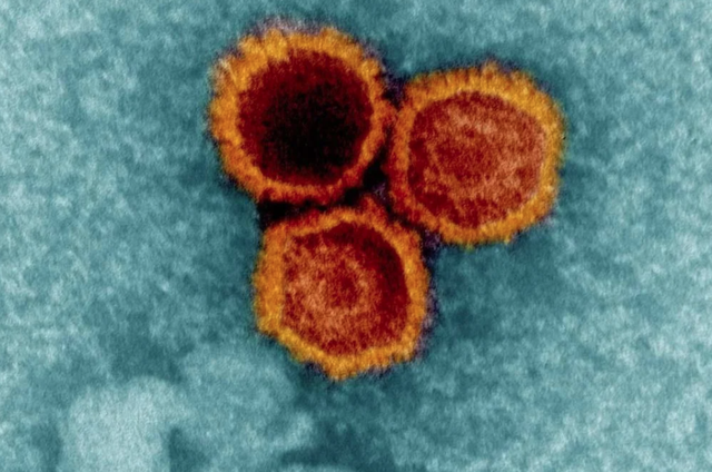 Scientists Develop New Antibody For Virus That Infects 95% of People - Ảnh 1.