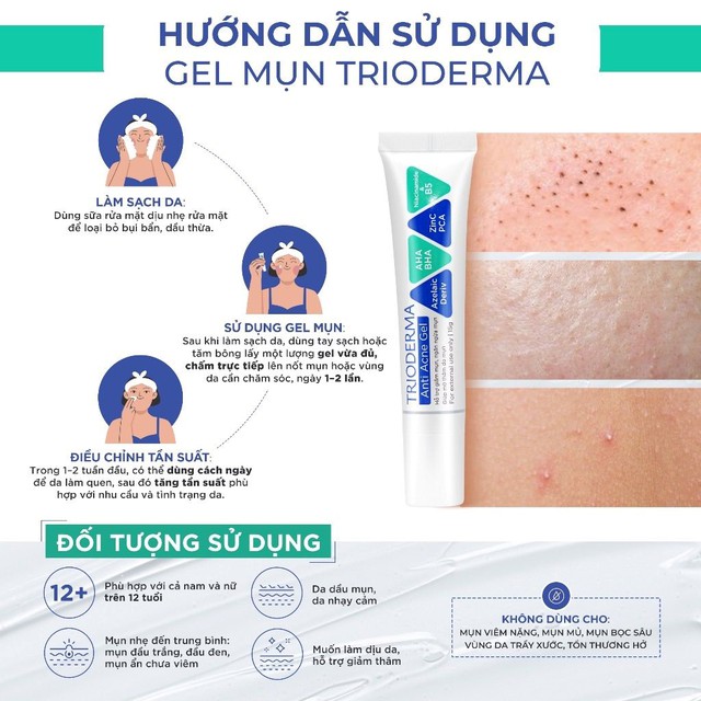 Review kem chấm mụn Trioderma Anti Acne Gel: V&igrave; sao lọt top &lsquo;b&aacute;n chạy&rsquo; tr&ecirc;n TikTok? - Ảnh 9.