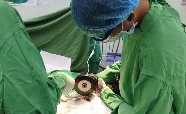 Su&yacute;t phải cắt bỏ dương vật bị 2 con ốc kim loại siết chặt - Ảnh 1.