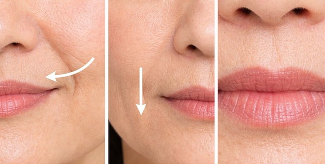 Cảnh b&aacute;o: 5 dấu hiệu da thiếu collagen &lsquo;trầm trọng&rsquo; m&agrave; 99% chị em đều bỏ qua- Ảnh 4.