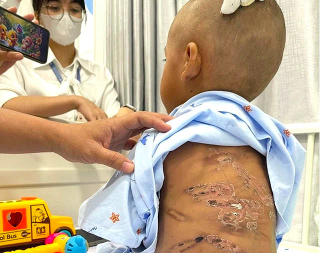 Đừng im lặng, h&atilde;y cứu mạng sống của trẻ em qua tổng đ&agrave;i 111 - Ảnh 1.