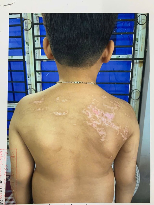 Bắt giam người cha đánh đập con trai dã man trong lúc dạy học bài- Ảnh 2.