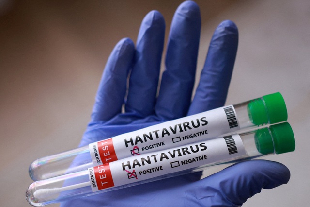 Số người nhiễm virus hanta gia tăng, đều thuộc biến thể l&acirc;y từ người sang người - Ảnh 1.