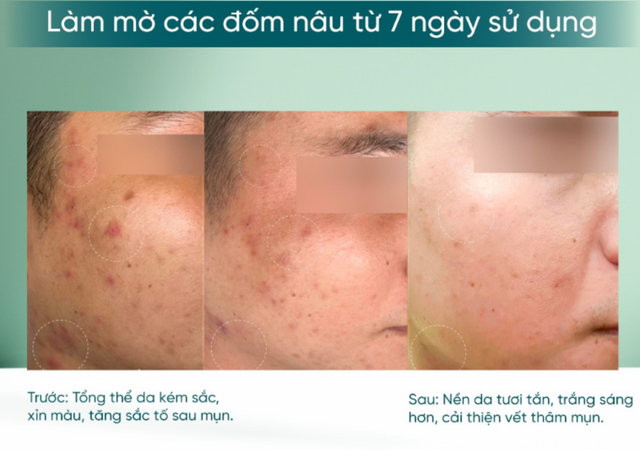 Lưu ngay 5 serum chống l&atilde;o h&oacute;a 'bơm đầy' collagen, da căng b&oacute;ng chẳng cần ti&ecirc;m filler- Ảnh 3.