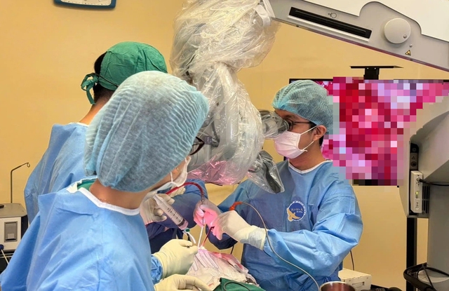 Chóng mặt, tăng huyết áp nhập viện phát hiện u màng não kích thước lớn - Ảnh 1.
