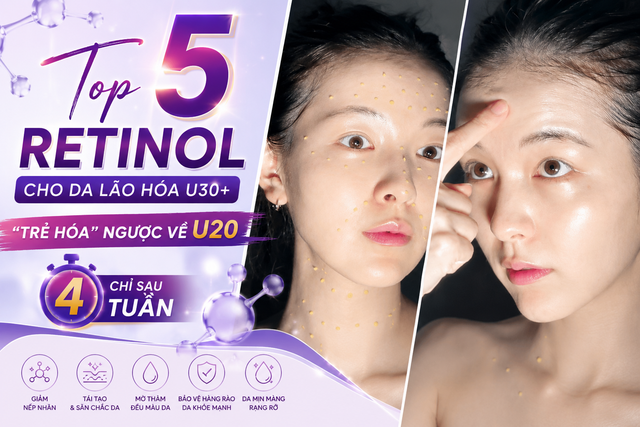 Top 5 retinol cho da l&atilde;o h&oacute;a U.30+ &lsquo;trẻ h&oacute;a&rsquo; tưởng như U.20 sau khoảng 4 tuần- Ảnh 1.