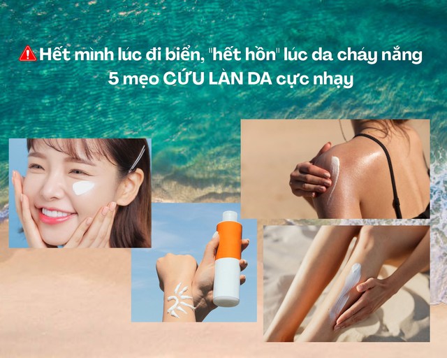 Hết m&igrave;nh l&uacute;c đi biển, 'hết hồn' l&uacute;c ch&aacute;y nắng: 5 mẹo cứu l&agrave;n da cực nhạy - Ảnh 1.