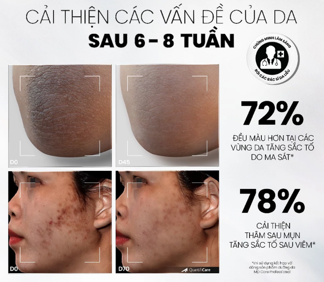 4 món mỹ phẩm ‘made in Vietnam’ có lượt bán top đầu sàn thương mại - Ảnh 5.