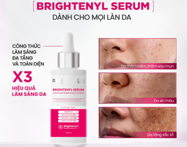 Top 7 kem giúp mờ nám da bật tone trắng hồng, hiệu quả cả nám hỗn hợp - Ảnh 6.