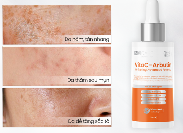 +5 serum dưỡng trắng luôn ‘hết hàng’ vì da glow và cải thiện tone da mỗi ngày - Ảnh 4.