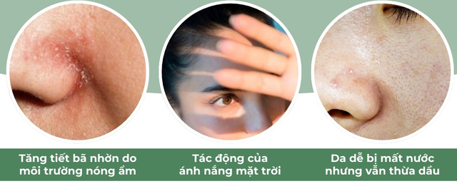 Hết tình trạng bí da mùa hè: Sản phẩm phục hồi này đang gây sốt khắp TikTok - Ảnh 2.