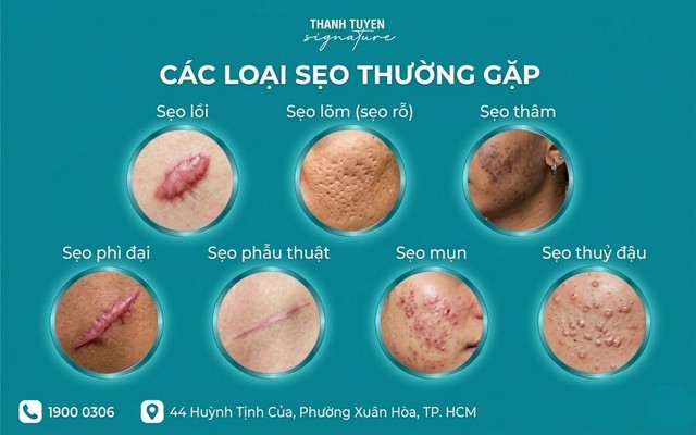 Th.S-Bác sĩ Thanh Tuyền khởi xướng dự án cộng đồng ‘Sẹo thẩm mỹ 0 đồng’- Ảnh 4.