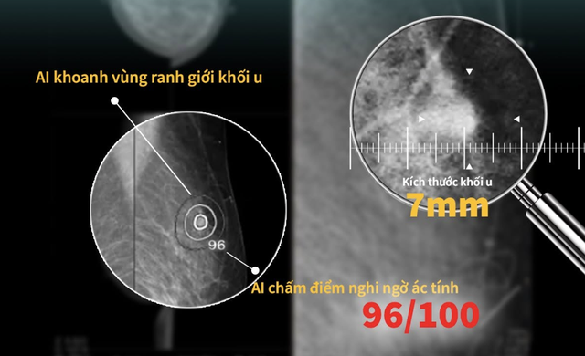 Dự b&aacute;o nguy cơ tim mạch 10 năm: Bước tiến mới của y học ứng dụng AI - Ảnh 1.