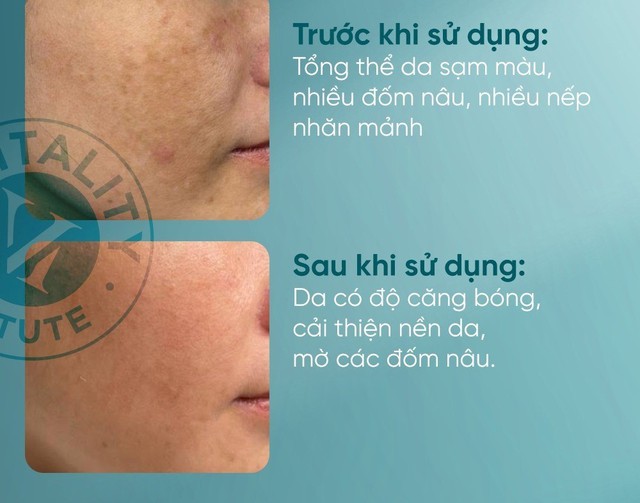 +4 retinol cho người mới bắt đầu gi&uacute;p da căng b&oacute;ng, rạng rỡ, kh&ocirc;ng bong tr&oacute;c - Ảnh 8.