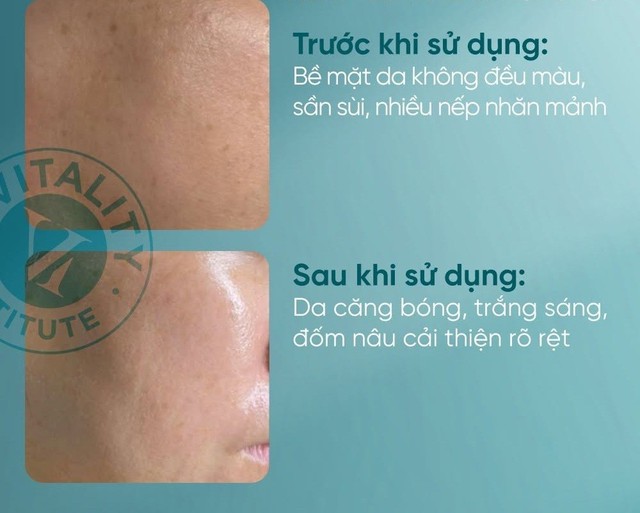 +5 kem trắng da chống l&atilde;o h&oacute;a cho U.40 tưởng U.20+, tuổi t&aacute;c chỉ l&agrave; con số- Ảnh 13.