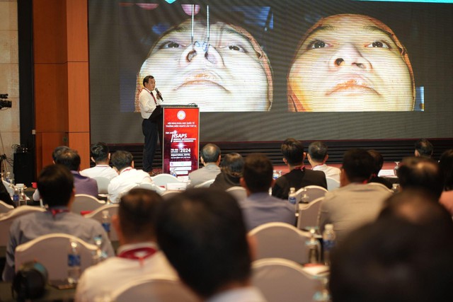 ThS-BS L&ecirc; Viết Tr&iacute; chia sẻ ba giải ph&aacute;p chỉnh sửa mũi m&ocirc;i dị tật - Ảnh 5.