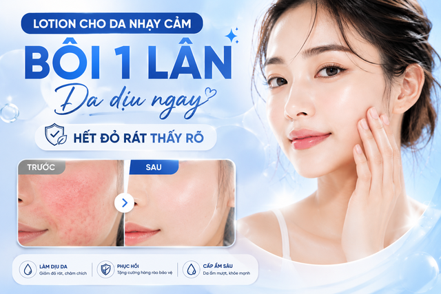 Lotion cho da nhạy cảm: B&ocirc;i 1 lần, gi&uacute;p l&agrave;m dịu da, giảm đỏ r&aacute;t thấy r&otilde;- Ảnh 1.