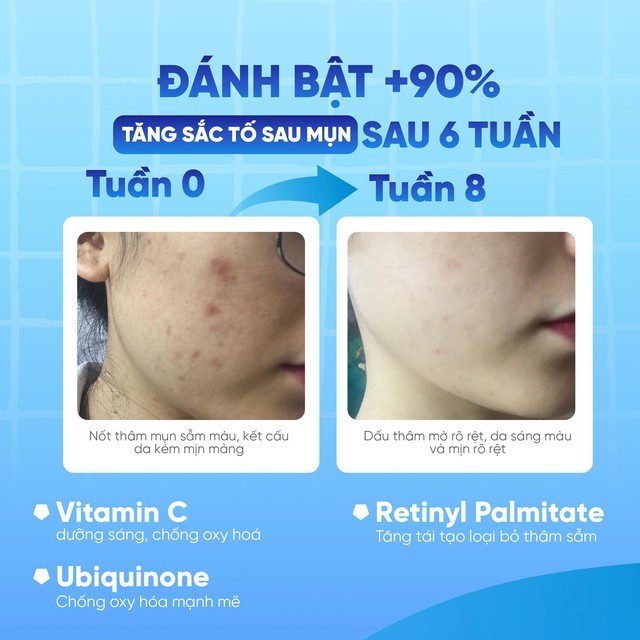 Review chi tiết kem Scar Esthetique làm mờ sẹo rỗ do mụn có tốt không?- Ảnh 3.