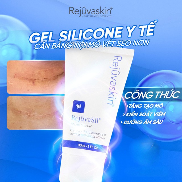Kem gi&uacute;p mờ sẹo lồi Rejuvasil c&oacute; hiệu quả kh&ocirc;ng m&agrave; được chuy&ecirc;n gia tin d&ugrave;ng?- Ảnh 1.