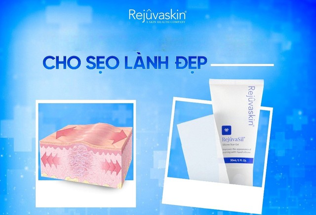 Kem gi&uacute;p mờ sẹo lồi Rejuvasil c&oacute; hiệu quả kh&ocirc;ng m&agrave; được chuy&ecirc;n gia tin d&ugrave;ng?- Ảnh 2.