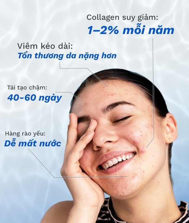 V&igrave; sao skincare rất nhiều nhưng da sau mụn vẫn kh&ocirc;ng đẹp l&ecirc;n? - Ảnh 2.