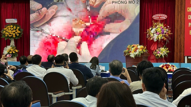 Mỗi tuần mổ 5 - 6 ca ung thư dương vật: Nỗi &aacute;m ảnh của đ&agrave;n &ocirc;ng - Ảnh 2.