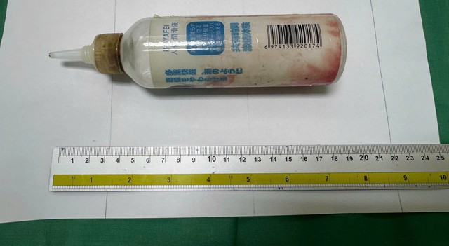 Lấy chai nhựa dài gần 20 cm trong trực tràng cho nam bệnh nhân 34 tuổi- Ảnh 2. Lấy chai nhựa dài gần 20 cm trong trực tràng cho nam bệnh nhân 34 tuổi- Ảnh 2.