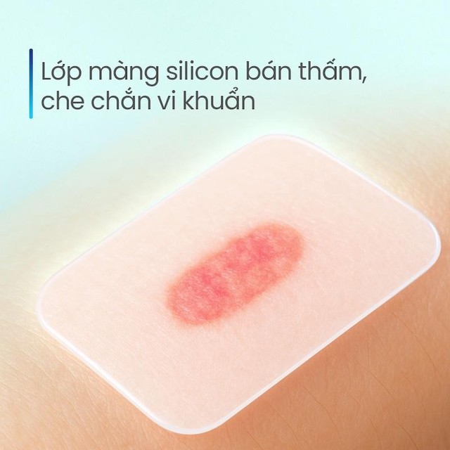 Vết loét lâu lành và nguy cơ hoại tử, dừng ngay việc tự xử lý tại nhà- Ảnh 3. Vết loét lâu lành và nguy cơ hoại tử, dừng ngay việc tự xử lý tại nhà- Ảnh 3.