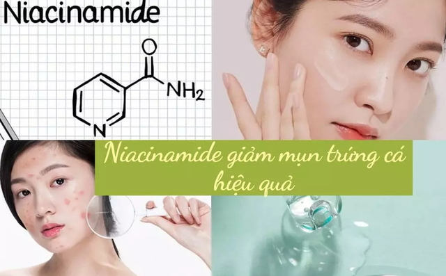 Niacinamide là gì mà hội skincare dùng hết chai thứ n vẫn lùng sục tìm mua?- Ảnh 3.