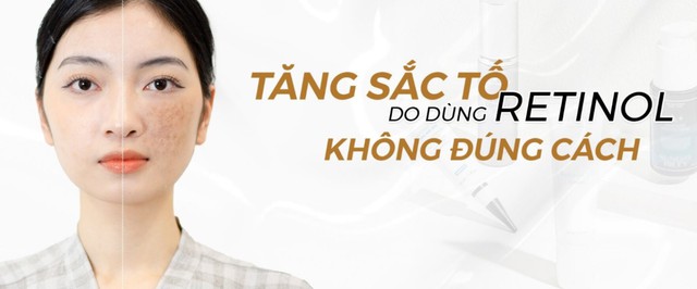 Mua retinol tiền triệu m&agrave; da vẫn xấu chỉ v&igrave; c&aacute;ch sử dụng retinol chưa đ&uacute;ng- Ảnh 3.