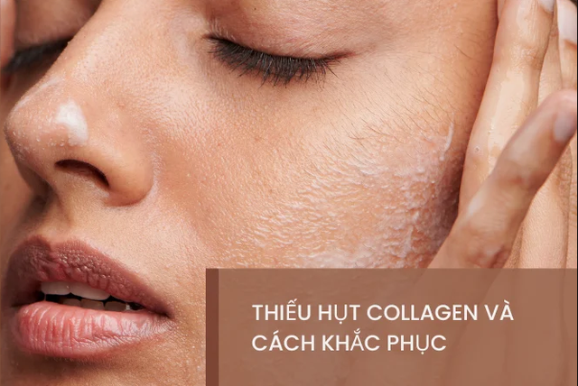Tưởng vô hại nhưng 5 thói quen này khiến collagen suy giảm ‘không phanh’ sau tuổi 25- Ảnh 1.