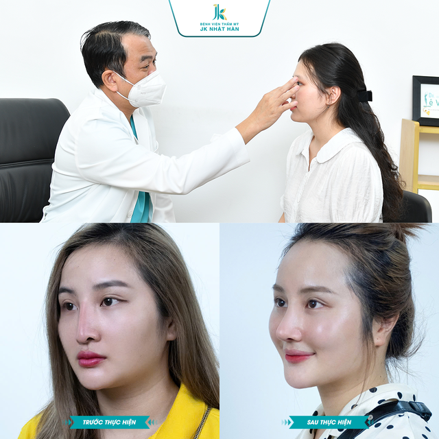 X&oacute;a mũi tẹt cho thanh thiếu ni&ecirc;n Việt - Trao cơ hội n&acirc;ng mũi miễn ph&iacute;- Ảnh 2.